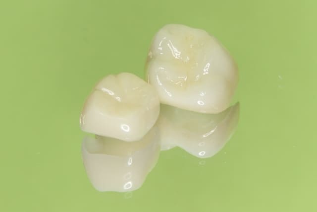 歯を白くキレイに治療する